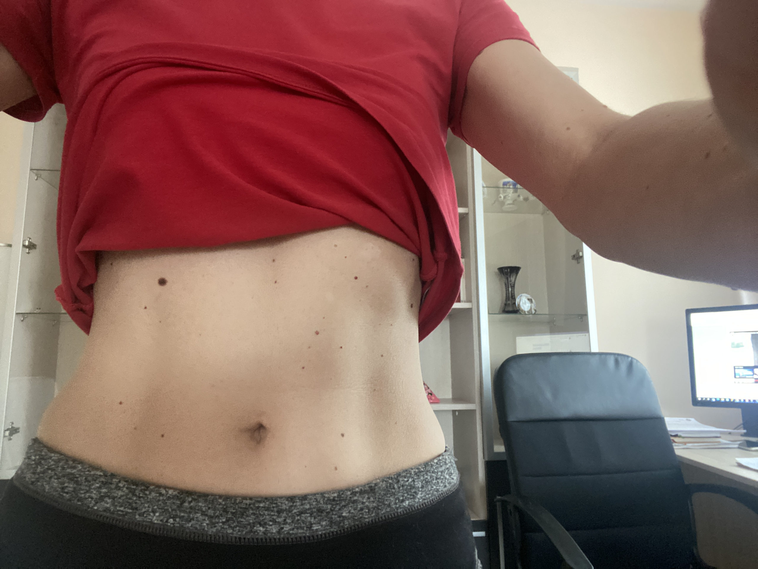 Krisztina__absBeforeAfter