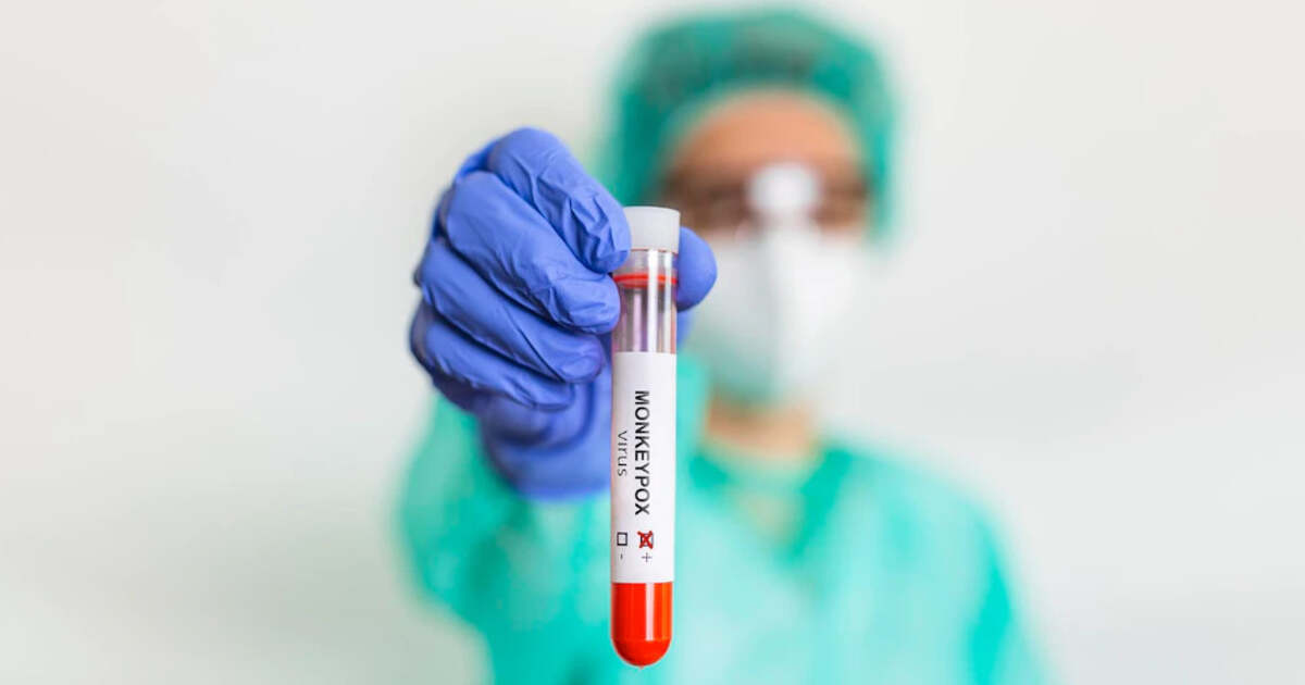 Învățăminte de la Babeș: Mpox, o nouă amenințare pentru sănătate Învățăminte de la Babeș: Mpox, o nouă amenințare pentru sănătate