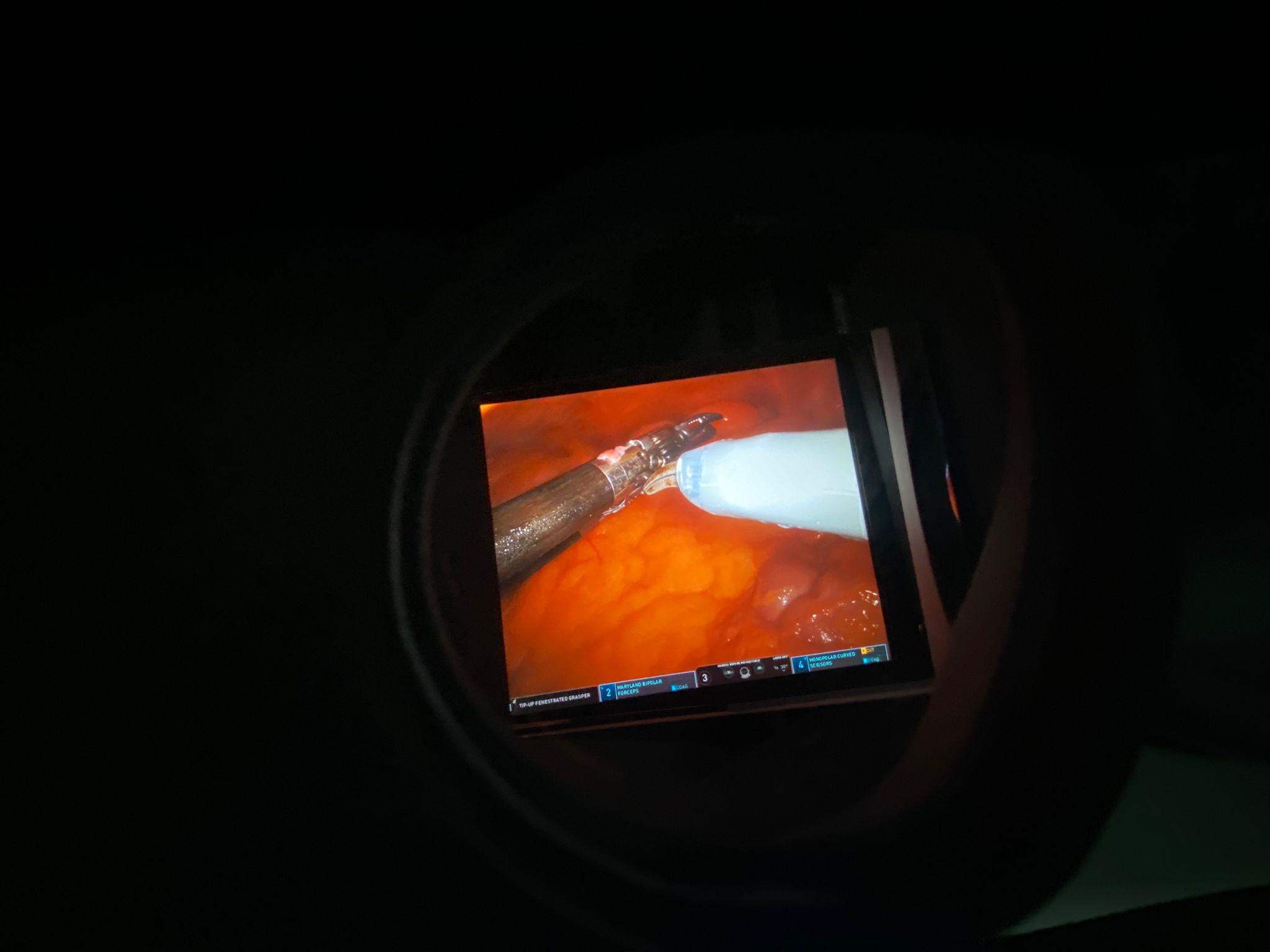 operatie medici chirurgi spital davinci (1)