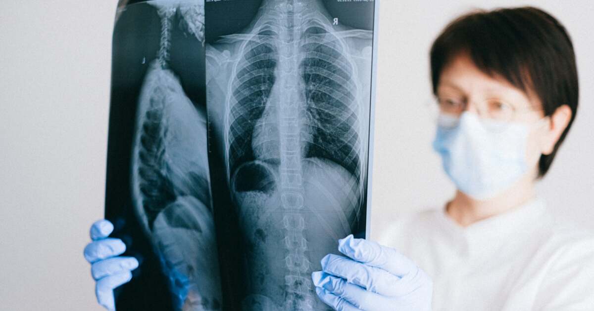 Ziua specială dedicată împotriva Tuberculozei. Boala mortală pentru mulți oameni. Ziua specială dedicată împotriva Tuberculozei. Boala mortală pentru mulți oameni.