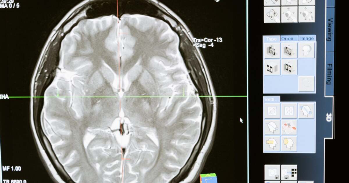 Vestul țării îmbunătățește diagnosticarea rapidă a problemelor neurologice pentru pacienți Vestul țării îmbunătățește diagnosticarea rapidă a problemelor neurologice pentru pacienți