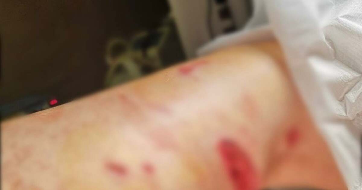 Investigație asupra modului în care polițiștii au intervenit în cazul femeii mușcate de câini, pe pistă de biciclete, între Timișoara și Serbia Investigație asupra modului în care polițiștii au intervenit în cazul femeii mușcate de câini, pe pistă de biciclete, între Timișoara și Serbia