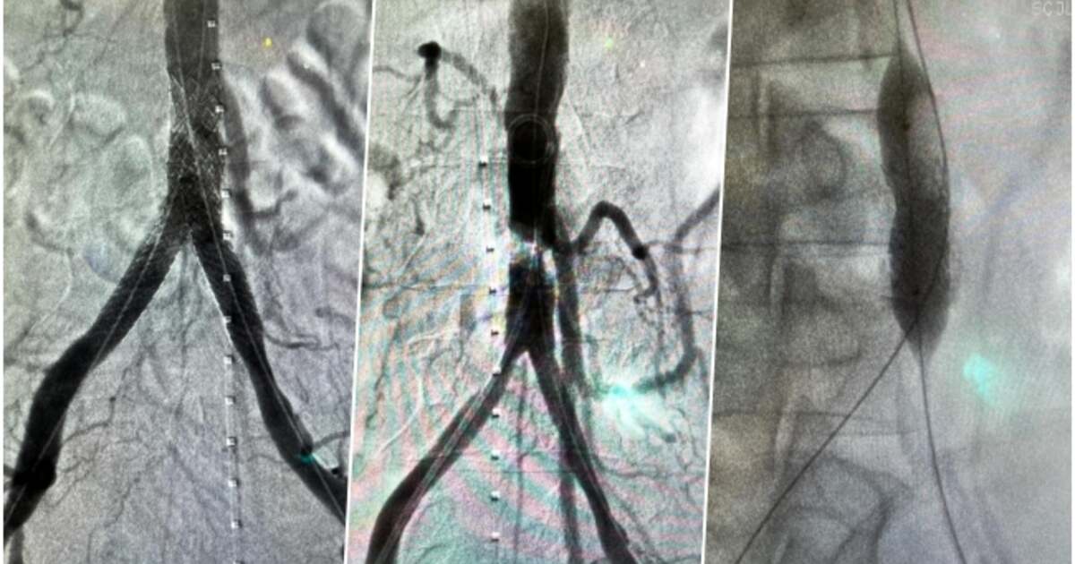 Intervenție medicală revoluționară la Spitalul Județean din vestul țării Intervenție medicală revoluționară la Spitalul Județean din vestul țării