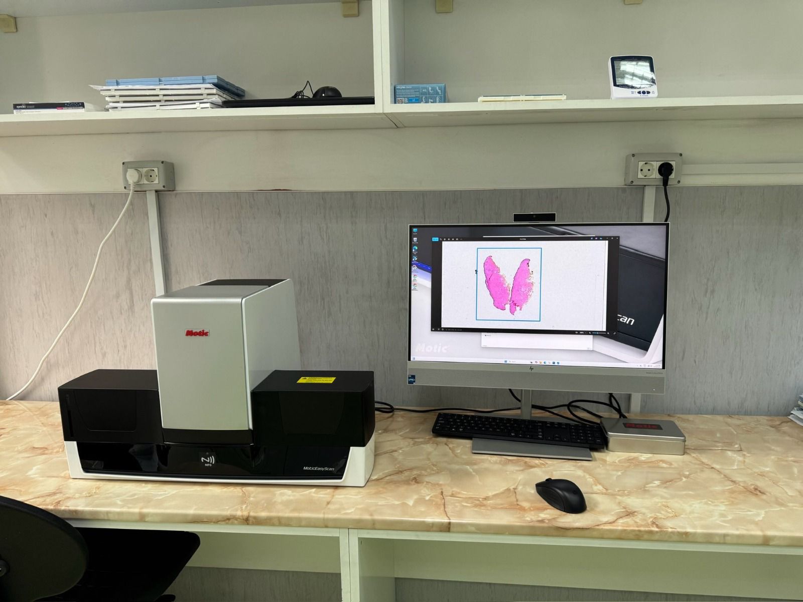 Terapia HIPEC la Spitalul Municipal (4)