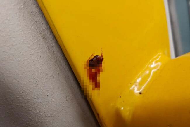 Poza pentru articolul Ploșnițe semnalate într-un tramvai din Timișoara. Ce spune STPT