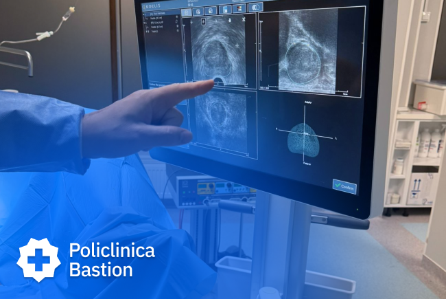 Poza pentru articolul Biopsia de prostată cu fuziune RMN: diagnostic precis, fără risc de infecție, în ambulator